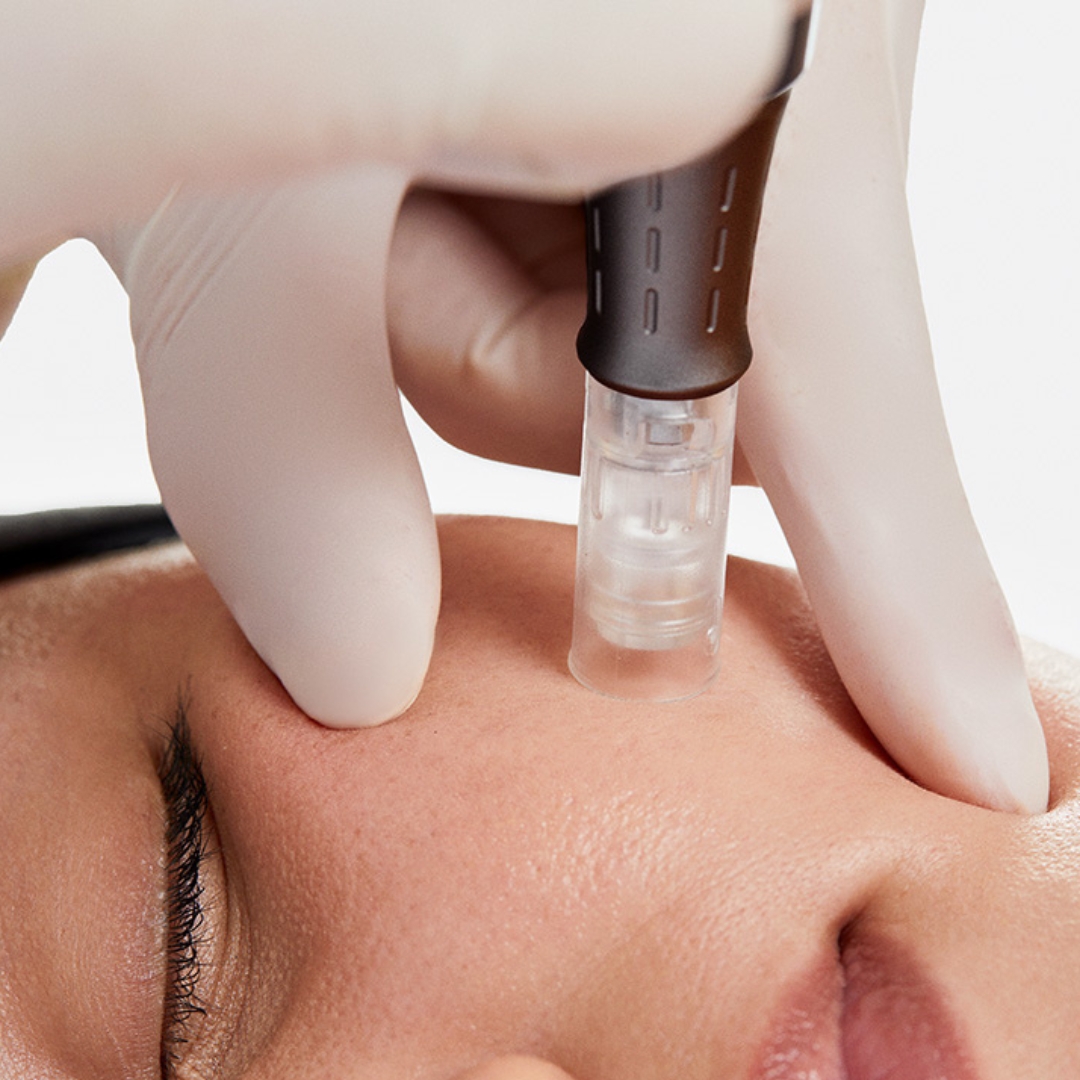 nanoinfuze